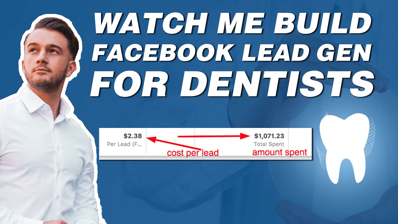 Lead Generation for Dentist  